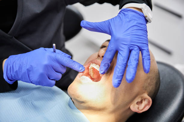 Best Teeth Whitening  in East Douglas, MA